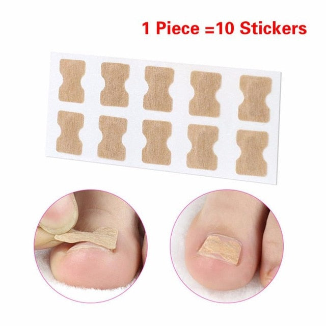 5Pcs Nail Strips Anti-roll Free Glue Toe Inlay Nail Corrector - COOLCrown Store